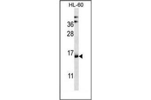 Western blot analysis of NDUFAF4 Antibody (N-term) in HL-60 cell line lysates (35ug/lane). (NDUFAF4 antibody  (N-Term))
