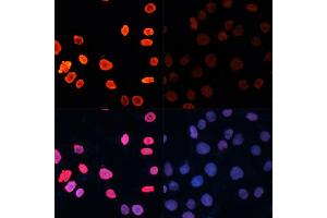 Immunofluorescence analysis of HeLa cells using Acetyl-Histone H3-K18 antibody (ABIN7267668) at dilution of 1:100. (Histone 3 antibody  (H3K18))