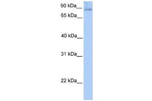 SLITRK1 antibody used at 1 ug/ml to detect target protein. (SLITRK1 antibody  (N-Term))