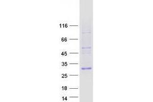 Western Blotting (WB) image for Twist Homolog 1 (Drosophila) (TWIST1) protein (Myc-DYKDDDDK Tag) (ABIN2734647)