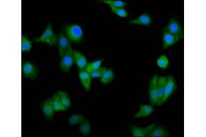 Immunofluorescence staining of HepG2 cells with ABIN7146463 at 1:66, counter-stained with DAPI.