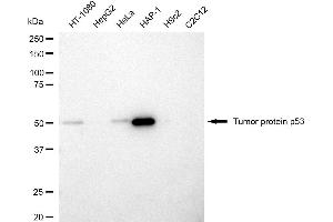 Western blotting analysis using tumor protein p53 antibody (ABIN7800685). (p53 antibody)