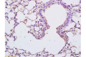 Formalin-fixed and paraffin embedded mouse lung labeled with Anti-MuRF1/Trim63 Polyclonal Antibody, Unconjugated (ABIN1387397) at 1:200 followed by conjugation to the secondary antibody and DAB staining. (Surfactant Protein C antibody  (AA 24-58))