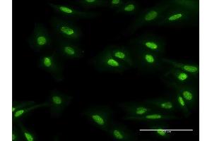 Immunofluorescence of monoclonal antibody to MBD5 on HeLa cell. (MBD5 antibody  (AA 1-229))