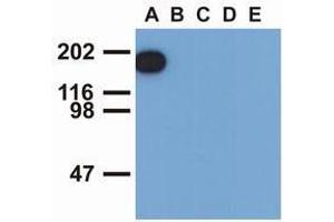 Western Blotting (WB) image for anti-Epidermal Growth Factor Receptor (EGFR) (pTyr1197) antibody (ABIN400879) (EGFR antibody  (pTyr1197))