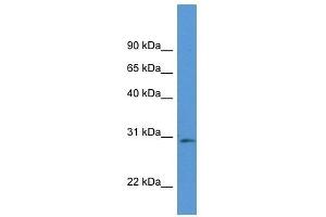Western Blot showing Rpia antibody used at a concentration of 1. (Ribose 5-Phosphate Isomerase A (RPIA) (Middle Region) antibody)