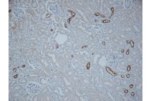 Immunohistochemistry (IHC) image for anti-Solute Carrier Family 12 (Sodium/Chloride Transporters), Member 3 (SLC12A3) (AA 74-95) antibody (ABIN863201)
