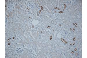 Immunohistochemistry analysis using Rabbit Anti-NCC Polyclonal Antibody (ABIN863201). (SLC12A3 antibody  (AA 74-95))