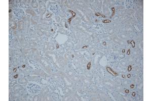 SLC12A3 antibody  (AA 74-95)