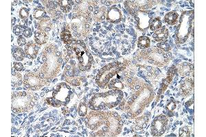Immunohistochemistry (IHC) image for anti-Uronyl-2-Sulfotransferase (UST) (C-Term) antibody (ABIN2782688) (UST antibody  (C-Term))