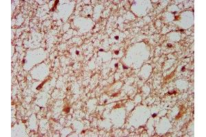 IHC image of ABIN7155757 diluted at 1:600 and staining in paraffin-embedded human brain tissue performed on a Leica BondTM system. (HOXD1 antibody  (AA 59-131))