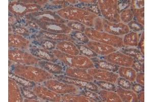 DAB staining on IHC-P; Samples: Human Kidney Tissue (PRTN3 antibody  (AA 71-247))