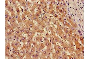 Immunohistochemistry of paraffin-embedded human liver tissue using ABIN7143681 at dilution of 1:100 (AOX1 antibody  (AA 236-421))
