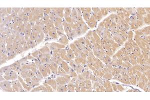 Detection of PIIINP in Porcine Cardiac Muscle Tissue using Monoclonal Antibody to Procollagen III N-Terminal Propeptide (PIIINP)