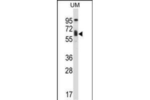 TCF3 Antibody (C-term) (ABIN657912 and ABIN2846860) western blot analysis in human uterine tumor tissue lysates (35 μg/lane).