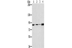 Gel: 6 % SDS-PAGE, Lysate: 40 μg, Lane 1-4: 823 cells, PC3 cells, 231 cells, hepg2 cells, Primary antibody: ABIN7130903(RNF214 Antibody) at dilution 1/250, Secondary antibody: Goat anti rabbit IgG at 1/8000 dilution, Exposure time: 20 seconds (RNF214 antibody)