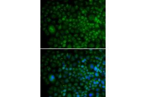 Immunofluorescence analysis of U2OS cells using ANG antibody (ABIN5970733). (ANG antibody)