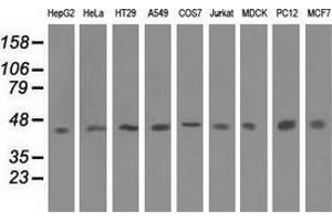 Western blot analysis of extracts (35 µg) from 9 different cell lines by using anti-IVD monoclonal antibody. (IVD antibody)