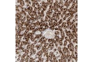 Immunohistochemical staining of human liver with EPG5 polyclonal antibody  shows strong cytoplasmic positivity in hepatocytes. (EPG5 antibody)
