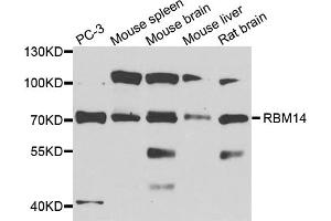 Western blot analysis of extracts of various cell lines, using RBM14 antibody (ABIN1874564) at 1:1000 dilution.