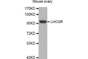 Western Blotting (WB) image for anti-Luteinizing Hormone/Choriogonadotropin Receptor (LHCGR) antibody (ABIN1980282) (LHCGR antibody)