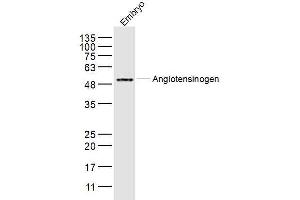 Image no. 1 for anti-Angiotensinogen (serpin Peptidase Inhibitor, Clade A, Member 8) (AGT) (AA 51-120) antibody (ABIN5675452)