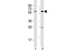 Western Blotting (WB) image for anti-SRY (Sex Determining Region Y)-Box 10 (SOX10) (AA 231-259) antibody (ABIN3032721)