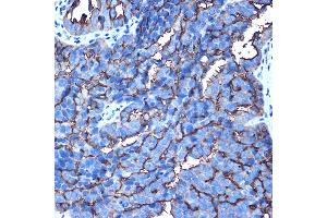 Immunohistochemistry (IHC) image for anti-Mucin 1 (MUC1) (AA 1182-1255) antibody (ABIN6144194)