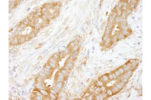 anti-Coronin, Actin Binding Protein, 1B (CORO1B) (AA 450-489) antibody