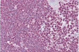 Immunohistochemistry with Thymus tissue at an antibody concentration of 5µg/ml using anti-CD40LG antibody (ARP33831_P050) (CD40 Ligand antibody  (Middle Region))