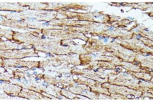 Immunohistochemistry of paraffin-embedded Mouse heart using SLC14A1 Polyclonal Antibody at dilution of 1:100 (40x lens). (SLC14A1 antibody)