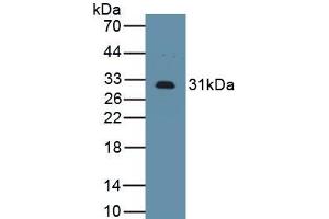 Detection of Recombinant IL2Ra, Mouse using Polyclonal Antibody to Interleukin 2 Receptor Alpha (IL2Ra) (CD25 antibody  (AA 22-235))