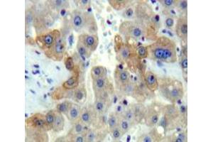 Used in DAB staining on fromalin fixed paraffin-embedded Liver tissue (DISC1 antibody  (AA 151-340))