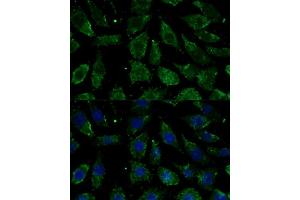 Immunofluorescence (IF) image for anti-NADH Dehydrogenase (Ubiquinone) 1 beta Subcomplex, 1, 7kDa (NDUFB1) (AA 1-105) antibody (ABIN7268808)