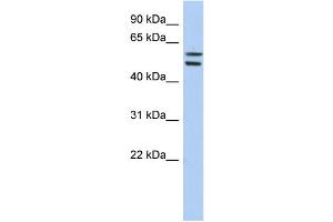 WB Suggested Anti-ZNF513 Antibody Titration:  0. (ZNF513 antibody  (Middle Region))