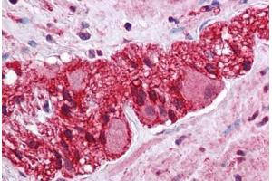 Human Colon, Myenteric Plexus: Formalin-Fixed, Paraffin-Embedded (FFPE) (LMBRD1 antibody  (C-Term))