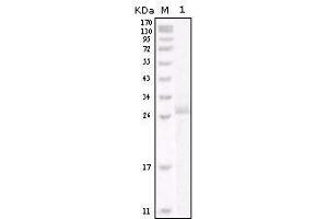 Western blot analysis using HER-2 mouse mAb against truncated HER-2 recombinant protein. (ErbB2/Her2 antibody)