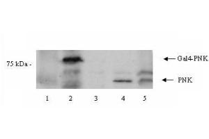 Western blot using  Affinity Purified anti-PNK antibody shows detection of a 57 kDa band corresponding to human PNK in a Y190 yeast cell lysate (lane 1), Y190 yeast cell lysate + human PNK (Gal DNA BP) (lane 2), EM9 XH Chinese hamster ovary cell lysate (lane 3), EM9 XH Chinese hamster ovary cell lysate + human PNK (lane 4) and a HeLa cell lysate (lane 5). (PNKP antibody  (Internal Region))