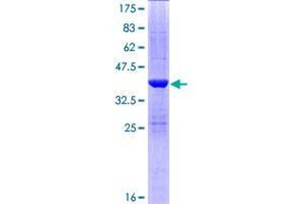 SULT1C4 Protein (AA 1-102) (GST tag)