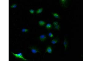 Immunofluorescence staining of U251 cells with ABIN7174397 at 1:100, counter-stained with DAPI. (FAM105B antibody  (AA 1-287))