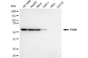 Western blotting analysis using P4HB antibody (ABIN7799919). (P4HB antibody)