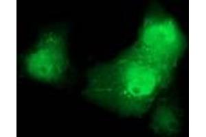 Image no. 1 for anti-Catenin (Cadherin-Associated Protein), beta 1, 88kDa (CTNNB1) antibody (ABIN1496891) (CTNNB1 antibody)