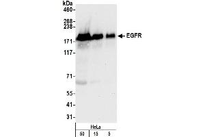 Western Blotting (WB) image for anti-Epidermal Growth Factor Receptor (EGFR) (C-Term) antibody (ABIN7454624)