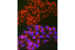 Immunofluorescence analysis of NIH-3T3 cells using TFEB Rabbit pAb (ABIN6128819, ABIN6149043, ABIN6149045 and ABIN6223149) at dilution of 1:100 (40x lens). (TFEB antibody)