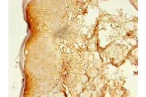 Immunohistochemistry of paraffin-embedded human skin tissue using ABIN7158219 at dilution of 1:100 (LSMEM2 antibody  (AA 1-96))