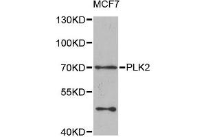 Western blot analysis of extracts of MCF7 cells, using PLK2 antibody. (PLK2 antibody)