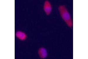 Immunofluorecence staining of Glypican 3 antibody on HepG2 cells.
