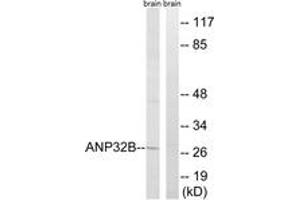 Western Blotting (WB) image for anti-Acidic (Leucine-Rich) Nuclear phosphoprotein 32 Family, Member B (ANP32B) (AA 1-50) antibody (ABIN2890087) (ANP32B antibody  (AA 1-50))