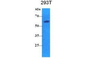 The cell lysates (40 ug) were resolved by SDS-PAGE, transferred to PVDF membrane and probed with anti-human PKLR antibody (1:500). (PKLR antibody  (AA 47-574))