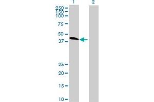 Western Blot analysis of ZFP2 expression in transfected 293T cell line by ZFP2 MaxPab polyclonal antibody. (ZFP2 antibody  (AA 1-461))